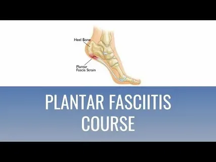 Diagnostic Steps a Plantar Fasciitis Doctor Uses to Rule out Tarsal Tunnel Syndrome